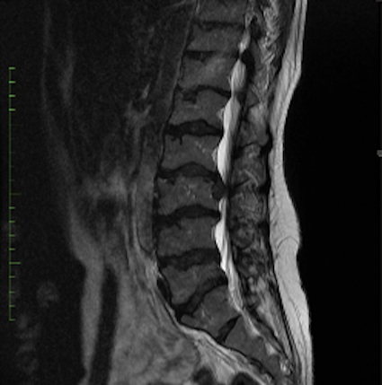 Figure 4 for case Kneist dysplasia